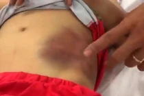 Xót xa những vụ cha mẹ bạo hành chính con ruột gây “nóng” dư luận