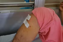 Bệnh nhân gãy xương ngực bị khoan chân: Áp lực khiến bác sĩ nhầm?