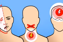 Dấu hiệu cảnh báo cơn đột quỵ “hỏi thăm” bạn