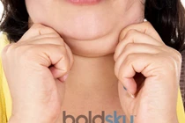 Cách lấy lại chiếc cổ thon gọn cho cô nàng ngấn cổ