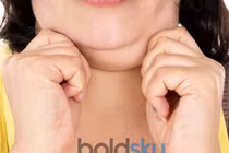 Cách lấy lại chiếc cổ thon gọn cho cô nàng ngấn cổ