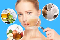 Bỏ túi những mẹo hay làm dịu da cháy nắng 