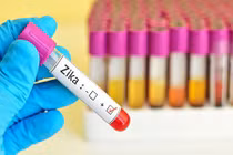 TP.HCM: Đã có 29 ca nhiễm Zika