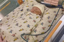 Em bé bị nứt bụng khiến ruột ngoài da sống sót kỳ diệu