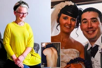 Khát khao làm mẹ của người phụ nữ mắc bệnh hóa đá