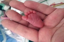 Bé sơ sinh nhỏ nhất thế giới chỉ nặng bằng quả ớt chuông