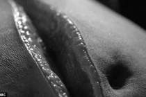 Quy trình khám nghiệm tử thi bệnh nhân béo phì chết vì suy tim