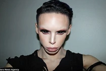 Chi bộn tiền dao kéo chỉ để giống người ngoài hành tinh