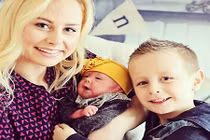 Em bé trông như người ngoài hành tinh vì thay da 4h/lần