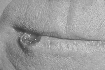 Cảnh giác dấu hiệu ung thư nếu từng quan hệ đường miệng