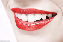 Những đồ ăn uống nên tránh để răng không bị biến màu