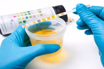 Thực hư uống nước tiểu thải độc tố, chữa bách bệnh? 