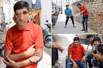 Khối u đáng sợ biến khuôn mặt trai trẻ thành mặt voi