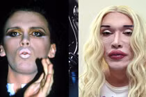 Huyền thoại nhạc Pop 300 lần dao kéo sửa phẫu thuật hỏng