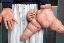 Những bộ phận cơ thể đạt danh hiệu "nhất" thế giới