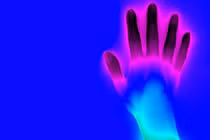 Lạnh tay chân tưởng vô hại nhưng có thể là bệnh tuyến giáp