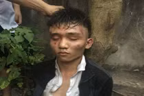 Hà Nội: Táo tợn dùng dao tấn công chủ quán cướp tài sản