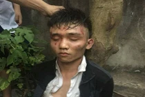 Hà Nội: Táo tợn dùng dao tấn công chủ quán cướp tài sản