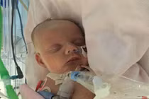 Cuộc chiến của bé 6 tuần tuổi bị thủng tim bẩm sinh