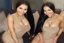 Cặp song sinh hối không kịp vì vung tiền dao kéo 