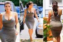 Sức hút của trào lưu phẫu thuật nâng mông kiểu Brazil