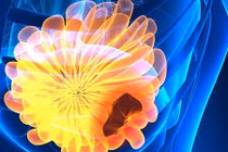 Cẩn trọng 4 dấu hiệu ung thư vú bạn chưa từng nghe