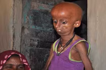 Xót xa thanh niên đôi mươi trong hình ảnh cụ già trăm tuổi