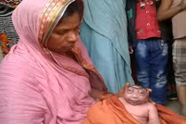 Sinh con như người ngoài hành tinh, mẹ không chịu cho bú