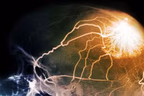 Hoạt động phức tạp của cơ thể con người khi chết não