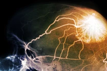 Hoạt động phức tạp của cơ thể con người khi chết não