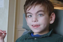 Cuộc sống của một em bé bị dị tật đầu nhỏ ra sao?