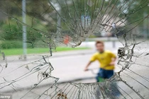 Cách sơ cứu nhanh những vết thương khi trẻ gặp tai nạn