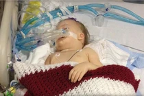 Bé 2 tuổi chết não vì hóc bỏng ngô