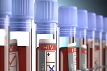 Rúng động sản phụ 9 lần bị chẩn đoán nhầm nhiễm HIV