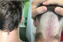 Ông bố tưởng bị chóng mặt phát hiện u não nhờ Facebook