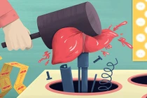 Thói xấu gây hại gan dù bạn không hề uống rượu