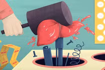 Thói xấu gây hại gan dù bạn không hề uống rượu