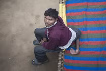 Hy hữu người 4 chân khẩn cầu bác sĩ cắt bớt 2 chân 