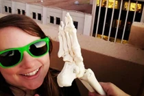 Cảm phục cô gái ung thư cụt chân đi khắp thế giới