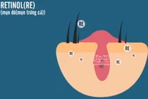 Video: Khám phá cơ chế hoạt động của các hoạt chất trị mụn