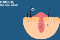 Video: Khám phá cơ chế hoạt động của các hoạt chất trị mụn