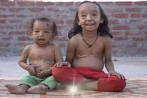 Kỳ lạ hai chị em 7 tuổi bị lão hóa thành... cụ già