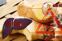 Top thực phẩm gây ngộ độc nếu không dùng đúng cách