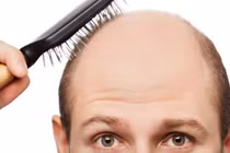 Video: Vì sao tóc rụng nhiều và hói đầu khi già?