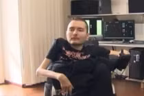 Người đầu tiên trên thế giới tình nguyện cấy ghép đầu