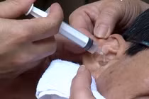 Các bước xử trí khi có dị vật trong tai