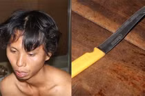 Đột nhập cơ sở thẩm mỹ, ép nữ nhân viên quan hệ tình dục