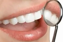 Những mẹo trị hôi miệng do sâu răng tại nhà