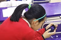 Dùng điện thoại, thiếu nữ bị biến dạng nghiêm trọng