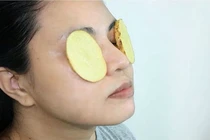 Trị bọng mắt, trị mụn, chống lão hóa chỉ bằng một củ khoai tây